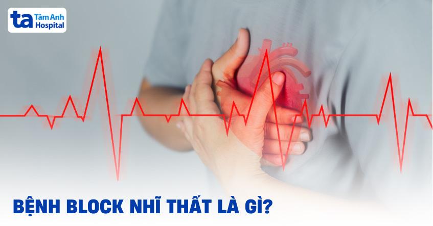 Block nhĩ thất là gì?