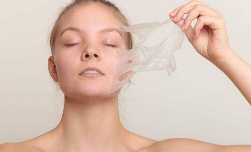Peel da hoá học có liên quan đến việc thoa dung dịch hóa học lên mặt để cải thiện vẻ ngoài của da